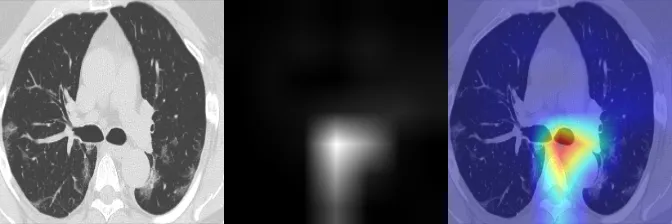 GradCAM visualization