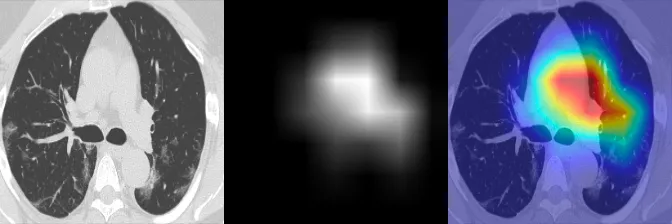 EigenCAM Visualization