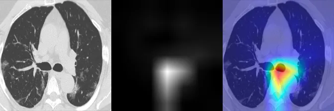 GradCAM Visualization