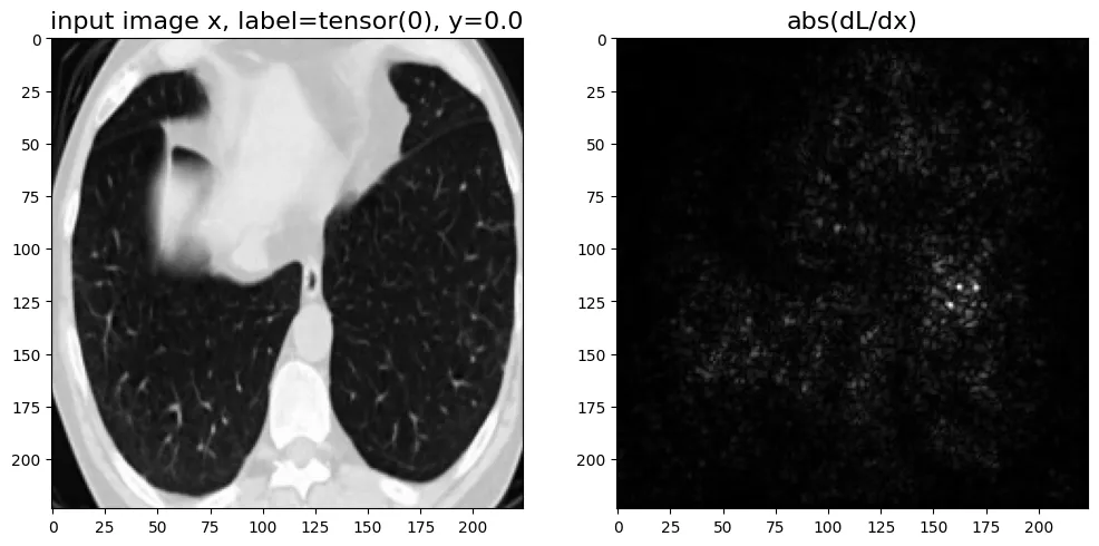 Gradient of loss with respect to input